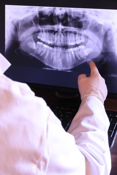 Best Dental Abscess Treatment in North Augusta, SC