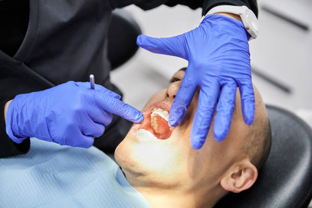 Best Emergency Treatment for Oral Infections in North Augusta, SC