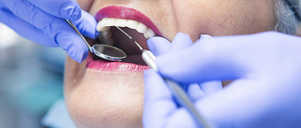 Best Broken or Chipped Tooth Repair in North Augusta, SC